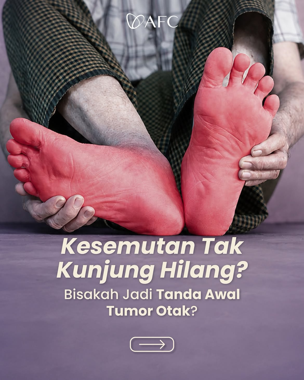 Kesemutan Tak Kunjung Hilang: Kapan Normal dan Kapan Perlu Diperiksakan?
